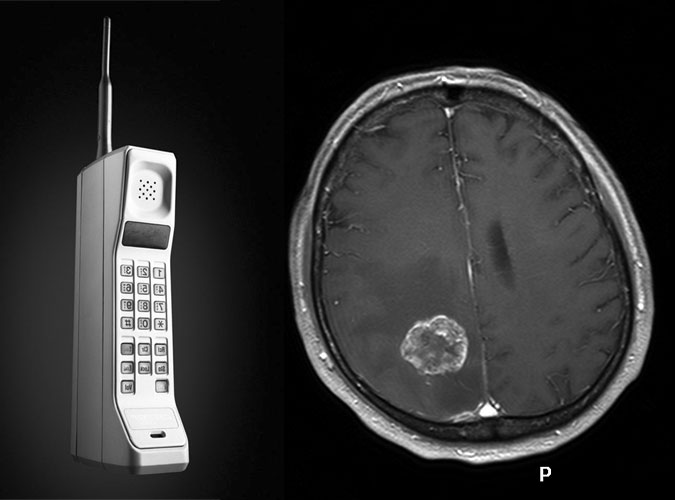 Tomi_Cancer_65 Tomi Cancer 65