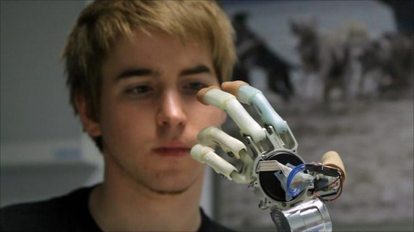 Bionic Prosthetic