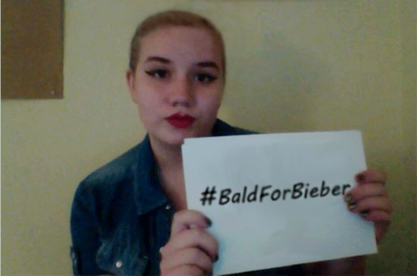 bald4bieber victim