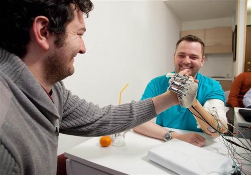 Pria Ini Jadi Orang Pertama Gunakan Tangan Bionik 2 bionic 2