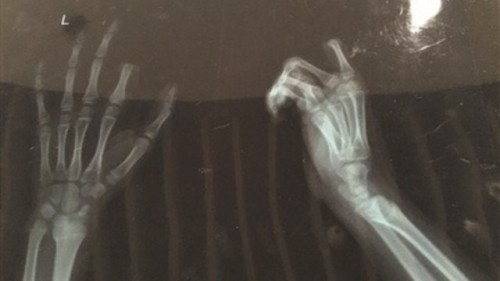 boy-finger-phone-640x360