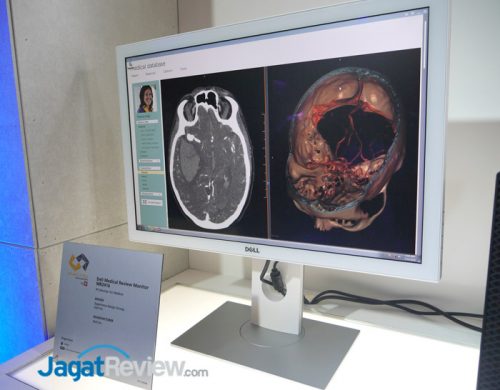 Dell-medical-Review-Monitor-MR2416