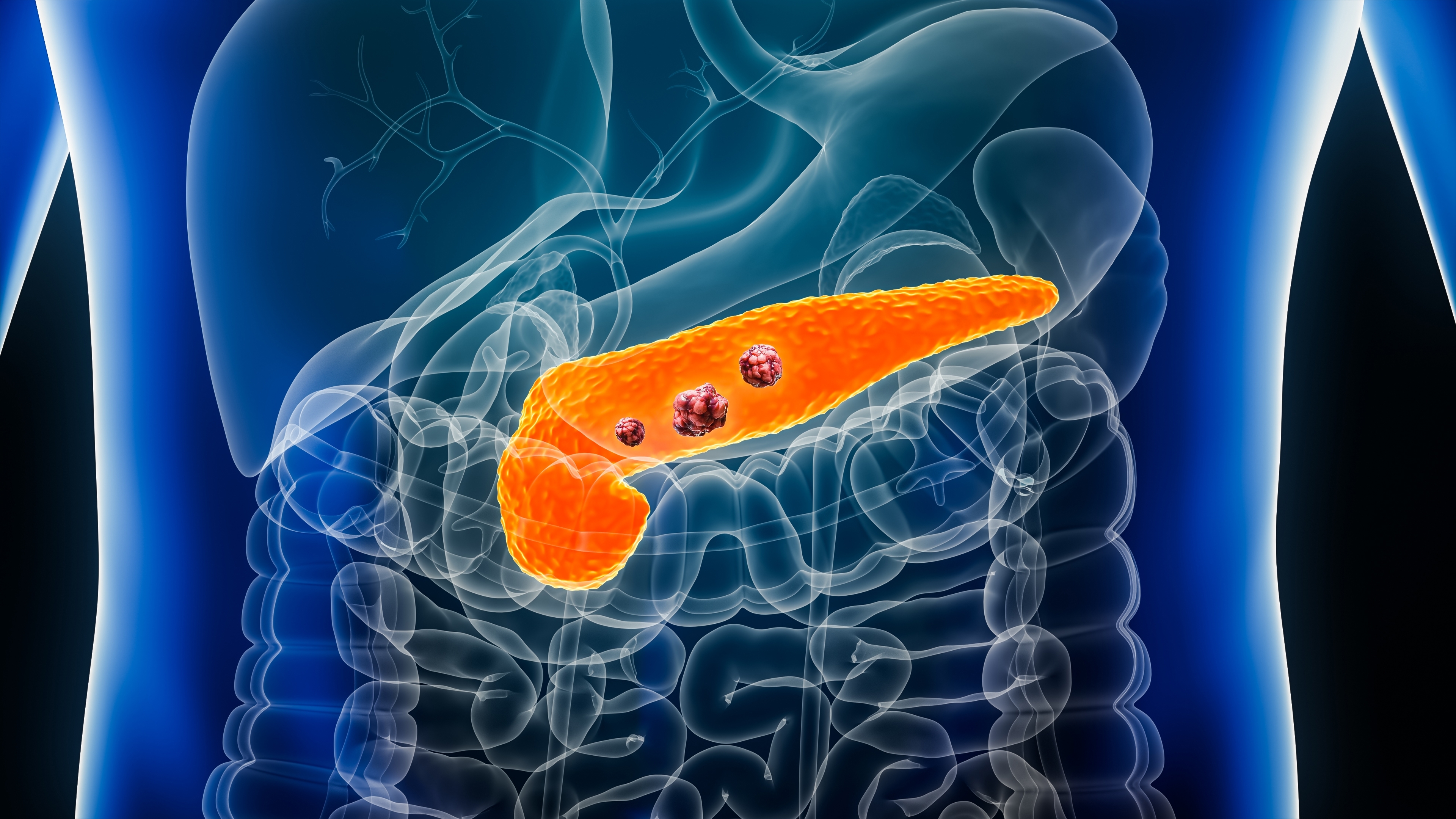 20230523 pancreatic 0