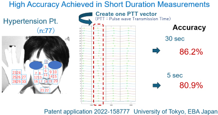 Peneliti Kembangkan Metode Deteksi Gula Darah dan Tekanan Darah Tanpa Sentuhan 2 2024 11 17 Optical blood measurements c